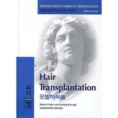 毛髮移植術, 正談