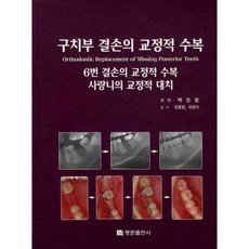 Myungmoon Publishing 後牙缺損的矯正修復, 白雲峰 著