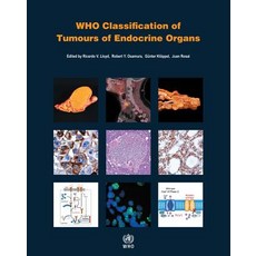 Who Classification of Tumours of Endocrine Organs Paperback, World Health Organization