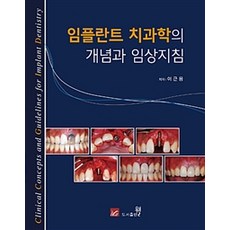 임플란트 치과학의 개념과 임상지침, 웰, 이근용 지음