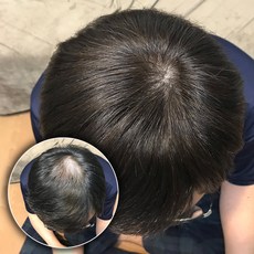 남성용 인모 정수리 부분가발 M2005, 흑갈색, 1개