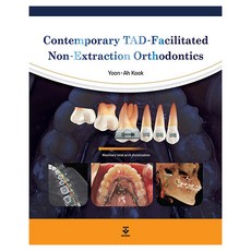 KOONJA 當代TAD輔助非拔牙正畸術精裝, 郭允兒, 君子出版社