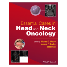 Essential Cases in Head and Neck Oncology, 威立