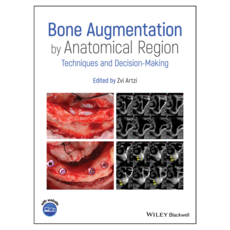 Bone Augmentation by Anatomical Region: Techniques and Decision-Making, Wiley