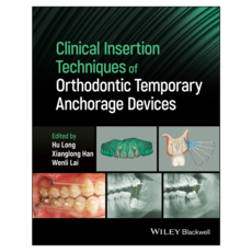 Clinical Insertion Techniques of Orthodontic Temporary Anchorage Devices, 와일리