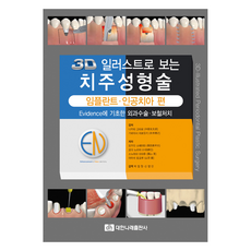 3D 일러스트로 보는 치주성형술:임플란트 인공치아 편, 대한나래출판사, 오카다 소헤이타 , 오다 노리미 , 소노야마 와타루 , 야마바 토오루 대한나래출판사, 오카다 소헤이타 , 오다 노리미 , 소노야마 와타루 , 야마바 토오루