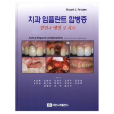 牙科植牙併發症的成因、預防與治療, 大韓娜萊出版社, Stuart J Froum