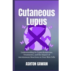 (영문도서)Cutaneous Lupus: Understanding Its Types Symptoms Treatments and the Impact o... Paperback, Independently Published, English, 9798273287358