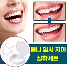[국내배송] 실리콘 틀니 미아 가짜 치아 장식 세트 임시치아 교정기 상하 이빨 셀프 만들기 보관함증정, 2개