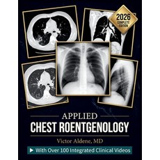 (英文圖書)Applied Chest Roentgenology: A Systematic Guide to Image Interpretation Differe... 平裝版, Independently Published, 英文, 平裝本