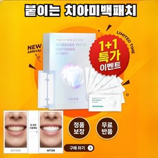 1+1 치아미백 패치 치아 미백 스트립, 14개, 1g
