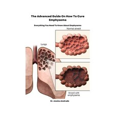 (영문도서) The Advanced Guide On How To Cure Emphysema: Everything You Need To Know About Emphysema Paperback, Independently Published, English, 9798366751957