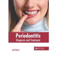 (영문도서) Periodontitis: Diagnosis and Treatment Hardcover, American Medical Publishers, English, 9781639277803