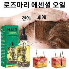 로즈마리 두피 오일 두피에센스 로즈마리 두피 헤어오일 탈모앰플 헤어에센스오일 두피 마사지 오일 100% 탈모에센스, 2개, 60ml