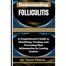 (英文圖書)Understanding Folliculitis: A Comprehensive Guide to Identifying Treating and... 平裝版, Independently Published, 英文