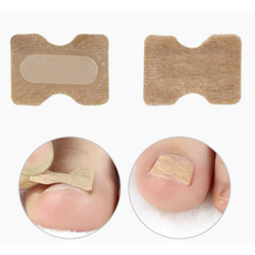 발톱 방지 스트립 셀프케어 파고드는 내성발톱 보호밴드 100개1세트, 1개