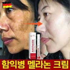 [효과짱] 멜라논 크림 기미 잡티 크림1위 얼굴 색소침착 착색크림 피부 재생 보습 탄력 미백 멜라토닝 미백 검버섯크림, 5개, 15g