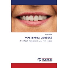 (영문도서)Mastering Veneers Paperback, LAP Lambert Academic Publis..., English, 9786208462727