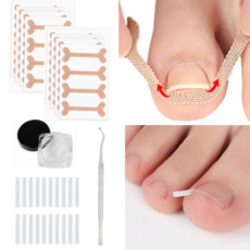 페어토 파고드는 발톱 관리용품 셀프 케어, 1개