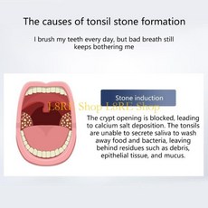 L8RE 편도선 추출 세트는 3 개의 소프트 팁 조정 가능한 흡입 강도 가시성 향상을위한 플라스틱 텍스처가, 01 White, 01 China Mainland