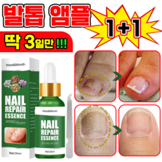 [국내배송] 발톱 거품나는앰플 솔루션 문제성발톱 앰플 발톱 곰팡이 한번에끝내는 손발톱 영양제 보장증정, 2개, 30ml