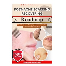 (英文圖書)Post-Acne Scarring Recovering Roadmap: Clear Steps For Managing And Reducing The... 平裝版, Independently Published, 英文