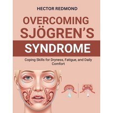 (英文圖書)Overcoming Sjögren's Syndrome： Coping Skills for Dryness Fatigue and Daily Com... 平裝版, Independently Published, English