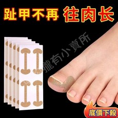 甲溝炎矯正貼片 嵌甲拉貼 腳趾甲護理工具 自帶膠40貼 免打磨無痛, 1個, 強效5.0版：自帶膠【40貼】免打磨無痛,#誰還有甲溝炎：修甲溝嵌甲【指甲矯正貼】