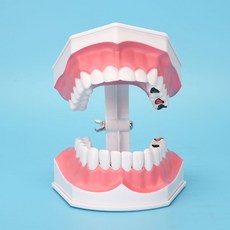 치과 치아 모형 교육 모델 브라켓 구강 덴티폼, 어린이 칫솔질 교육 키트