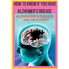 (영문도서) How to know if you have Alzheimers disease: Sign And Symptoms for Alzheimer's disease Paperback, Independently Published, English, 9798373177719