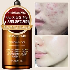 로리앤첼 글로리어스 에센스 앰플 세럼 80g, 1개