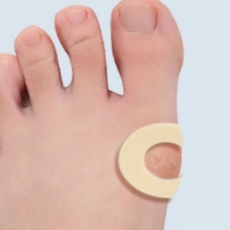 티눈제거밴드 새끼발가락굳은살통증 발가락티눈제거 발바닥굳은살위치 티눈밴드, 2개