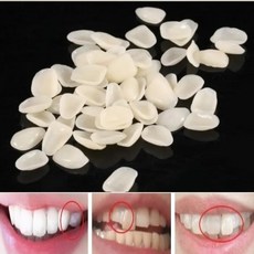 [국내출고] 미용 모형치아 임시 가짜이빨 미국 판매 셀프 성형 가공 프리 사이즈 50ea, 1개