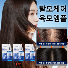 탈모완화 발모앰플 모낭활성화 두피영양 헤어세럼 발모부스터 모발밀도UP, 3개, 30ml