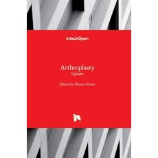 (영문도서) Arthroplasty: Update Hardcover, Intechopen, English, 9789535109952