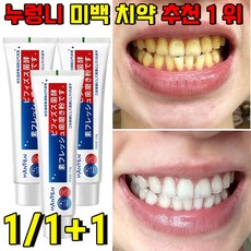 누렁니 미백 치약 추천 1 위 화이트닝 치약 치아 미백 치약 입냄새 제거 110g [매일 10명의 주문 고객님께 사은품 증정], 1개