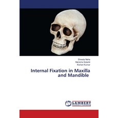 (영문도서)Internal Fixation in Maxilla and Mandible Paperback, LAP Lambert Academic Publis..., English, 9786207473908