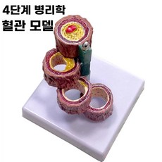 심혈관모형 동맥경화혈관모형 해부학 모델 혈전 고지혈증 인체 병원 교육용, B.네개의혈관, 1개