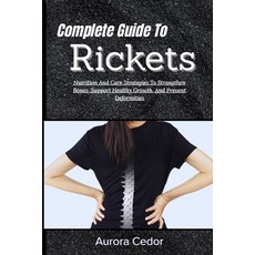 (영문도서)Complete Guide To Rickets: Nutrition And Care Strategies To Strengthen Bones Su... Paperback, Independently Published, English, 9798195946609 Independently Published, English, 9798195946609