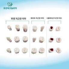치과 시뮬레이션 헤드 모델 치석제거 셀프 치아 교육, 화이트 26 1개, 1개, 1L