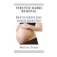 (영문도서) Stretch Marks Removal: How to remove your stretch marks fast Paperback, Independently Published, English, 9781097469215