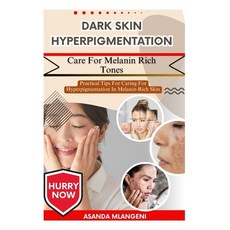 (英文圖書)Dark Skin Hyperpigmentation Care For Melanin Rich Tones: Practical Tips For Cari... 平裝版, Independently Published, 英文