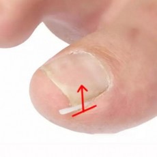 커브스틱 발톱관리 10pcs 손톱 발톱 도구 정리 케어 관리 세트, 1개, 상세페이지 참조