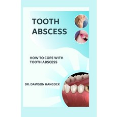 (영문도서) Tooth Abscess: How to Cope with Tooth Abscess Paperback, Independently Published, English, 9798858477020