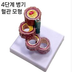 심혈관모형 동맥경화혈관모형 해부학 교육용 병원 심혈관 혈관모형 의학 단면 모델 경화, 네 개의 혈관