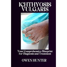 (영문도서) Ichthyosis Vulgaris: Your Comprehensive Blueprint for Diagnosis and Treatment Paperback, Independently Published, English, 9798334120266