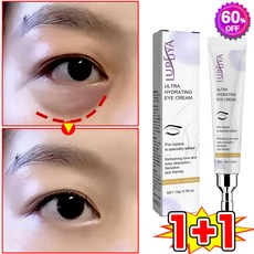 [피부과 추천] 1/1+1/2+2 눈밑지방 아이백 리프팅 아이크림 눈 밑 지방 제거 크림 아이백 크림 다크서클 눈밑꺼짐 제거 눈가 주름개선 LUPEIYA 포장증정, 2개, 15g