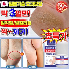 [고보습] 일본기술 1/1+1/2+2 풋크림 발각질제거 크림 풋케어 스틱 발크림 발뒤꿈치 굳은살 제거 발갈라짐 크림 LUPEIYA, 30ml, 1개, 1개입