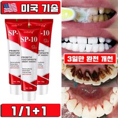 미국 1/1+1 SP10 미백 치약 누렁니 제거 입냄새 제거 프로바이오틱 화이트닝 미백 치약 치아미백 대용량 프리미엄 사은품 랜덤 증정, 1개, 120g