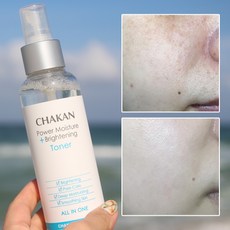 기미 잡티 주근깨 미백 색소침착 착색 검버섯 수분 보습 화이트닝 광채 기미잡티 미스트, 1개, 150ml